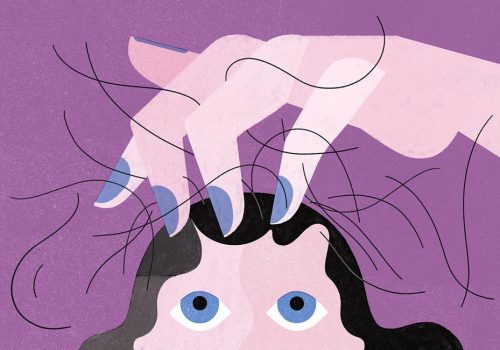 cómo evitar la caída del cabello en mujeres